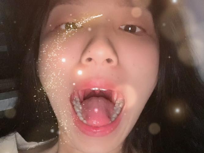 重庆口腔检查第一视角真的有用吗？