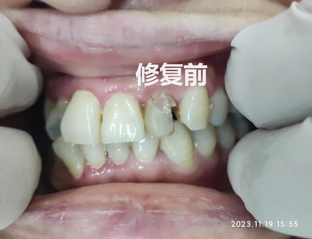 重庆口腔诊疗服务怎么挑不踩坑？看牙前你最好先把这几条搞明白