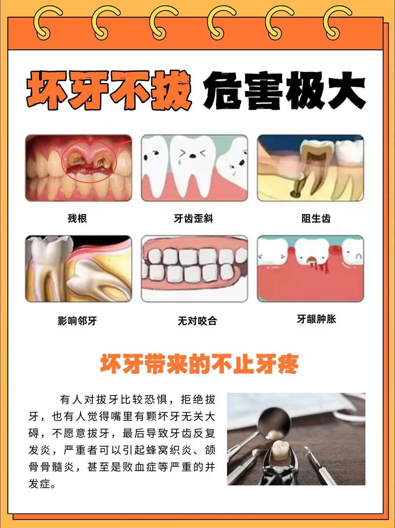 重庆大牙拔掉后不种植 小心这些后果