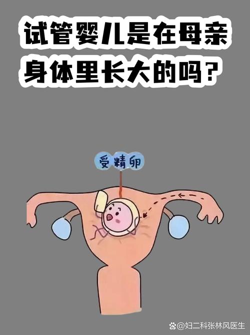 重庆试管婴儿常见误区有哪些 专家一次说清