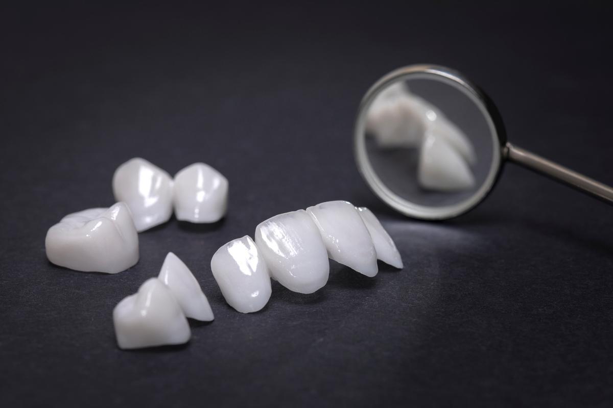 重庆牙齿矫正贴片价格揭秘：不同材质与方案费用详解