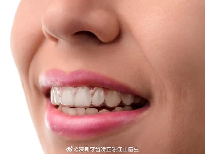 重庆成年人矫正牙齿多久能好？揭秘快速整牙的真相与代价