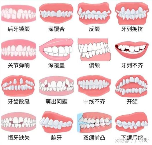 重庆儿童牙齿矫正一般价格多少？带娃整牙到底花几万