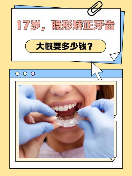 重庆德韩隐形矫正牙齿效果好吗 价格多少
