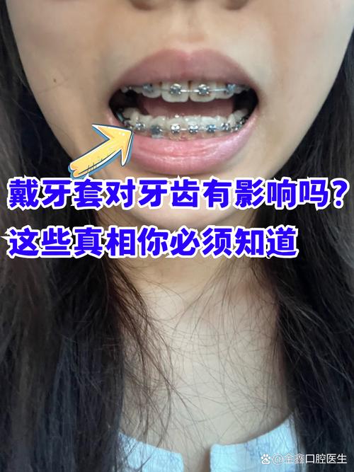 重庆成人矫正牙齿口腔值得做吗 这些真相医生不会主动说
