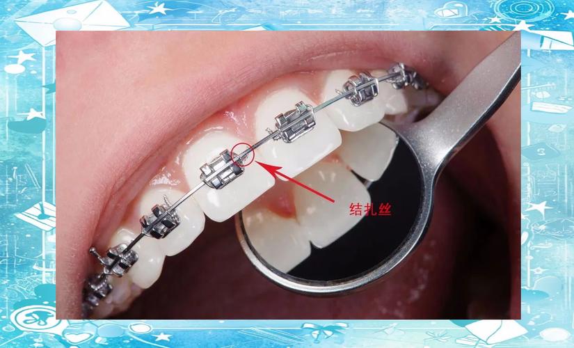 重庆牙齿矫正哪种方法好？从效果和舒适度来对比