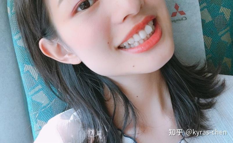 重庆成人门牙不齐矫正真的很简单吗