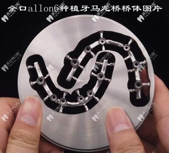 重庆深圳半口All-on-4种植牙医院怎么选？地址与避坑指南