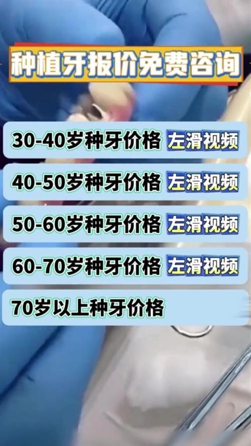 重庆南充半口种牙到底要花多少钱？2026年真实报价揭秘