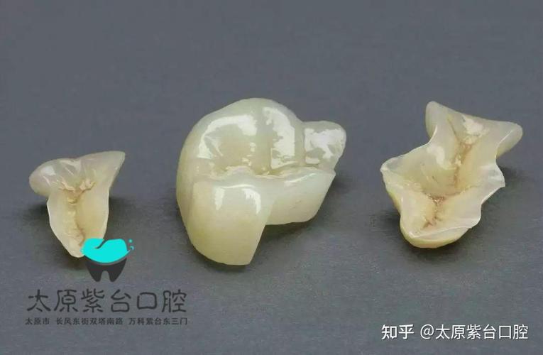 重庆口腔检查反馈单看不懂？3步教你秒读