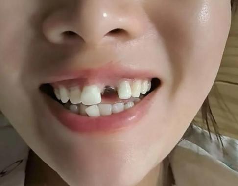 重庆看牙能网上问医生吗？口腔在线解答到底靠不靠谱