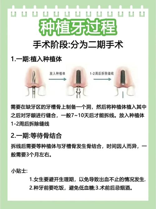 重庆种牙不是埋种子等发芽 手术过程疼不疼要多久