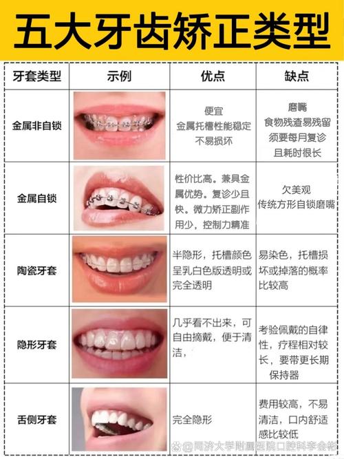 重庆21岁矫正牙齿不晚！成人正畸时长与效果解析