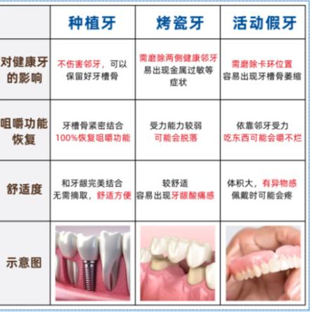 重庆赤峰种牙别乱选 公立三甲医院才靠谱