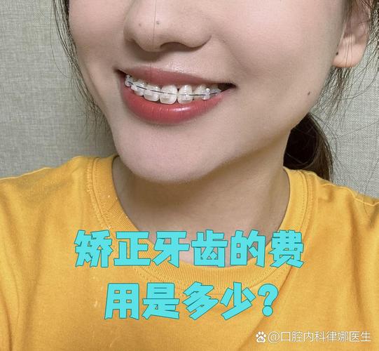 重庆纠正牙型费用全解析：矫正牙齿一般要多少钱