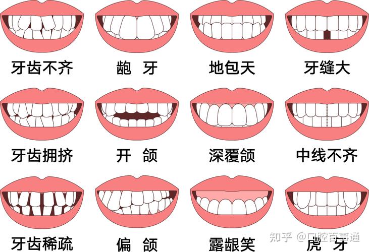 重庆25岁矫正牙齿还来得及吗真实经历分享