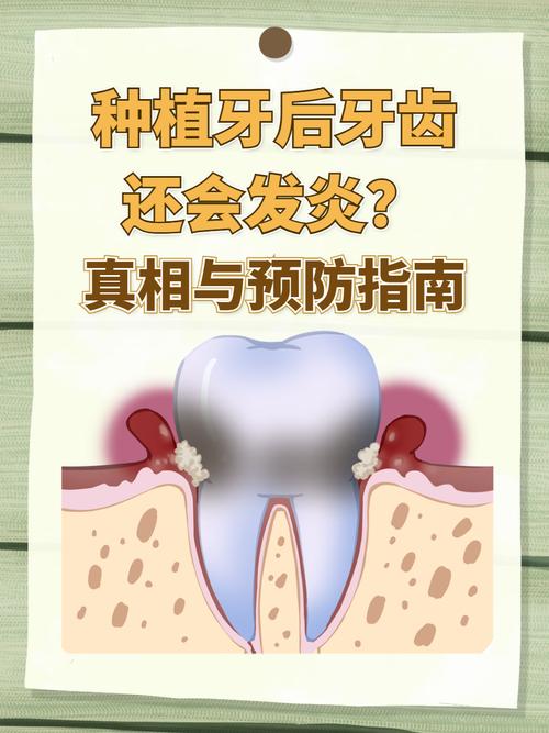 重庆种植牙严重松动发炎，什么情况需要拔除？