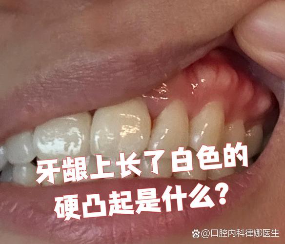 重庆缺一颗牙一定要种吗 不种的后果你承受得起吗