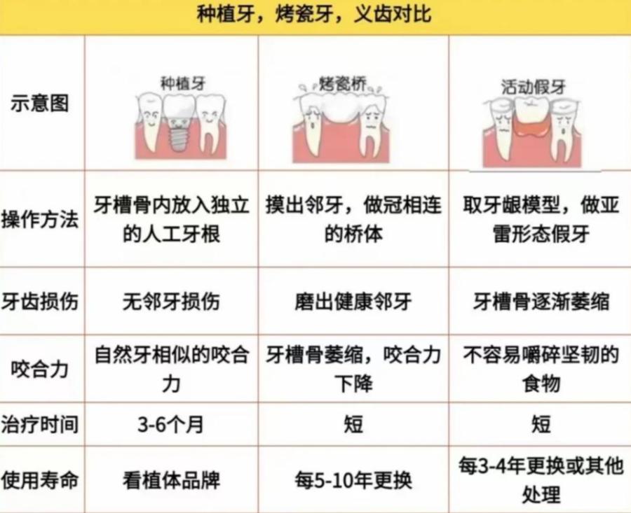 重庆2万块种牙到底够不够 真实费用全解析
