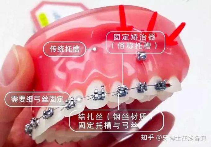 重庆深圳龙岗做隐适美矫正到底要花多少钱？