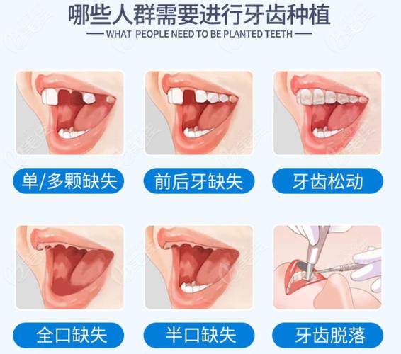 重庆保定口腔医院收费多少钱？看牙项目全解析