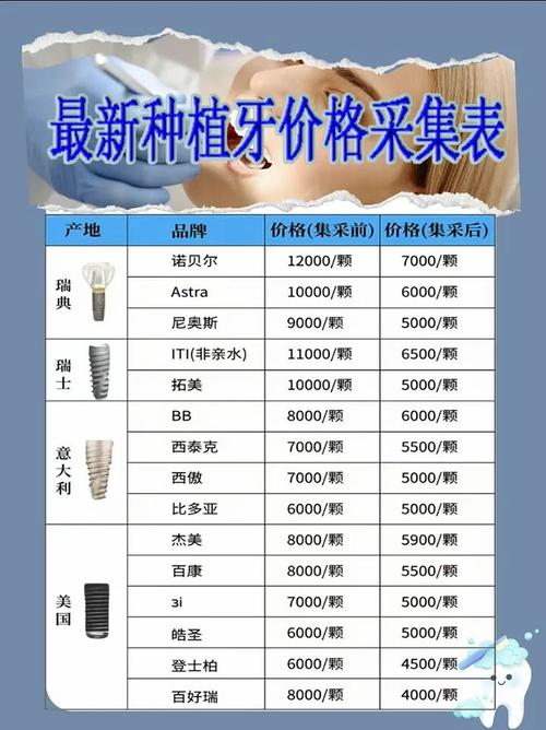 重庆半口种植牙多少钱？3万起还是10万起？看品牌和骨量
