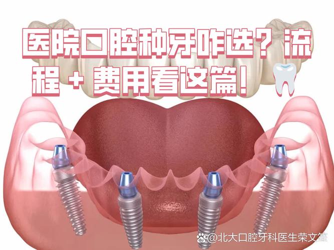 重庆深圳连锁牙科种牙贵不贵？值不值得选？