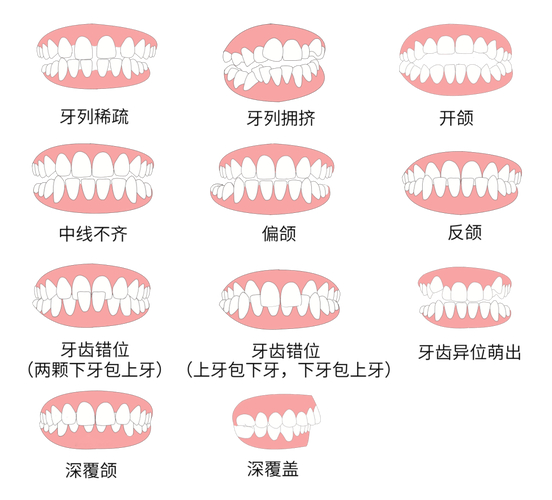 重庆30岁做牙齿矫正到底值不值 利与弊全分析