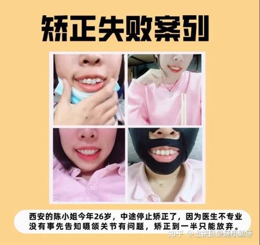牙齿矫正排名医院临沧有几家_临沧牙齿矫正医院排名_牙齿矫正排名医院临沧哪家好