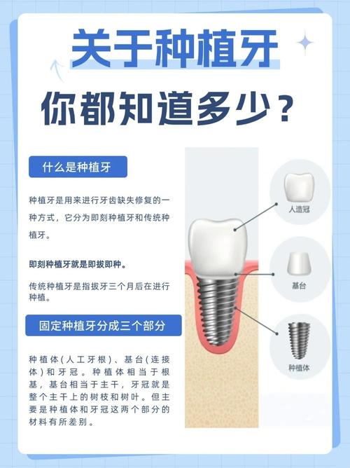 重庆4颗牙一起种到底靠不靠谱 种植医生一次性讲清楚