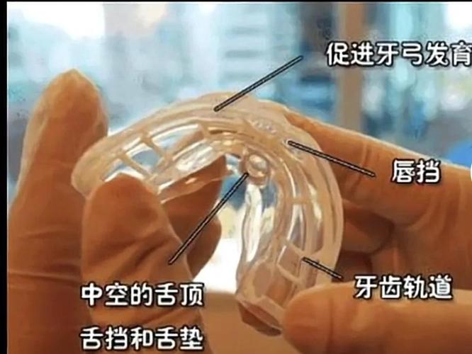 重庆深圳南山儿童隐形MRC矫正费用到底多少钱？