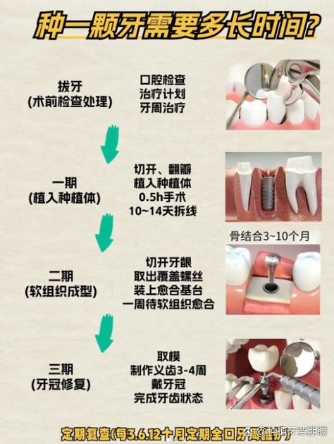 重庆种牙前做CT是必须的吗 2026种牙CT检查费用全解析