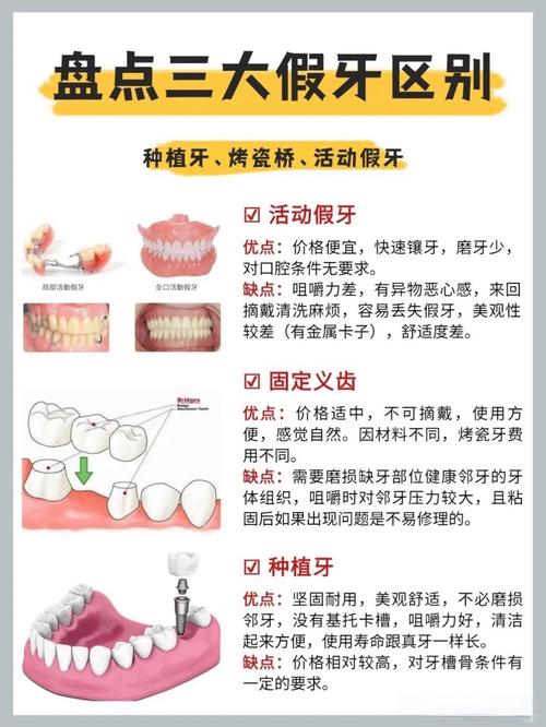 重庆牙齿掉了是种牙还是镶牙 种牙过程和价格一文说清