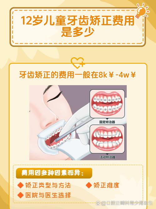 重庆12岁矫正牙齿要多少钱？医生揭秘各阶段费用明细