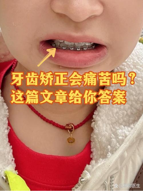 重庆19岁做牙齿矫正晚不晚 过来人告诉你真实经历