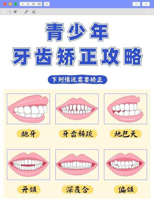 重庆15岁牙齿不齐别慌！抓住矫正黄金期，这些方法快收藏