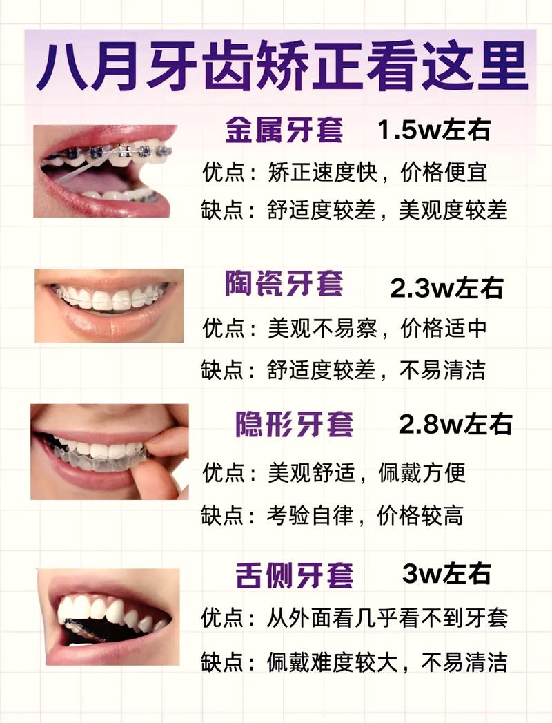 重庆门牙突出矫正费用全解析 看完这篇不再被坑