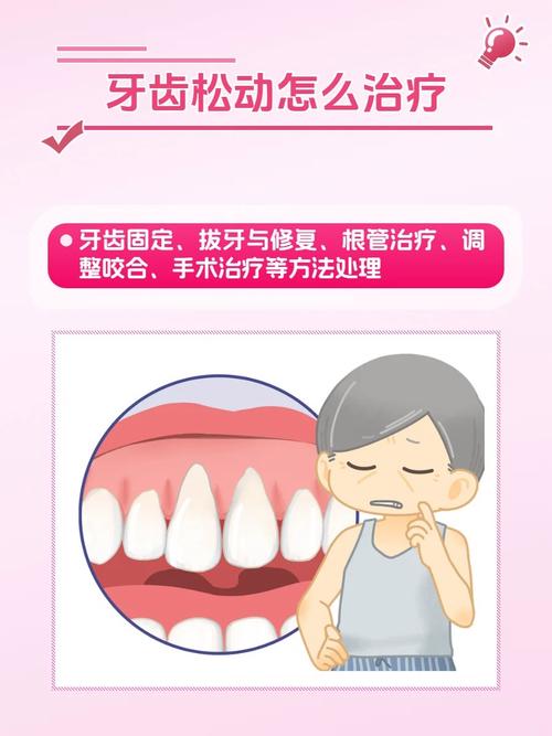 重庆牙齿松动能即拔即种吗 医生说出3个关键条件
