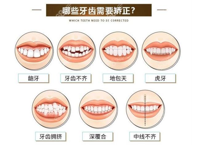 重庆38岁矫正牙齿晚不晚 别让年龄成为你犹豫的借口
