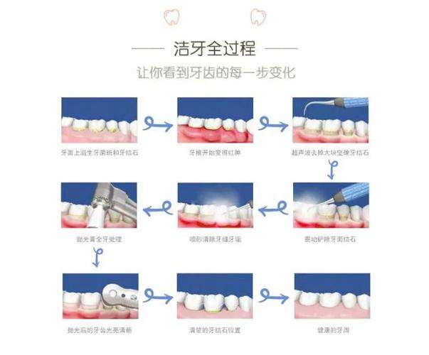 重庆深圳宝安隐适美正品认证医院怎么选？
