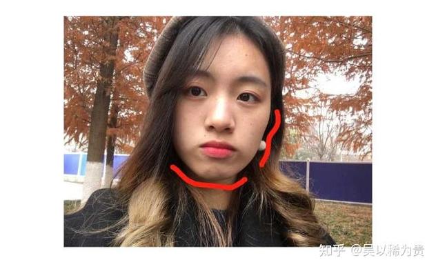 重庆莲塘小孩正畸多少钱？费用明细和避坑指南