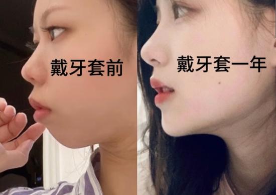 重庆郴州做牙齿矫正哪家好?看完这篇不踩坑