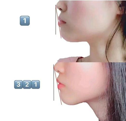 重庆34岁做龅牙矫正还来得及吗？我的真实感受