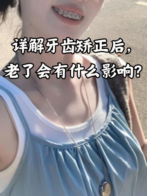 重庆40岁还能矫正牙齿吗？看完这篇文章让你了解40岁牙齿矫正的真相