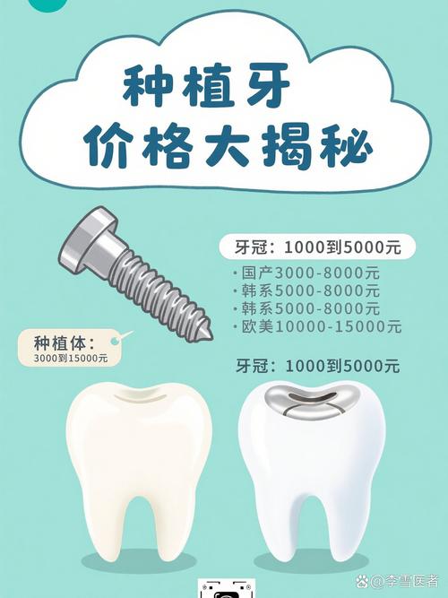 重庆奥齿泰种牙贵不贵？一颗的价格究竟是多少？看完这篇就知道！