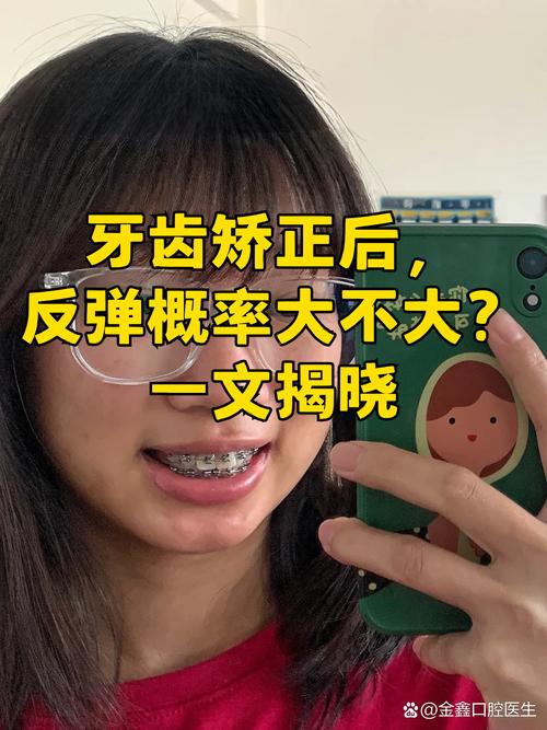 重庆19岁做牙齿矫正晚不晚 过来人告诉你真实经历
