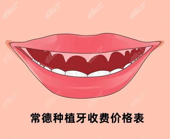 重庆常德半口种植牙费用2026大概多少钱？真实价格参考